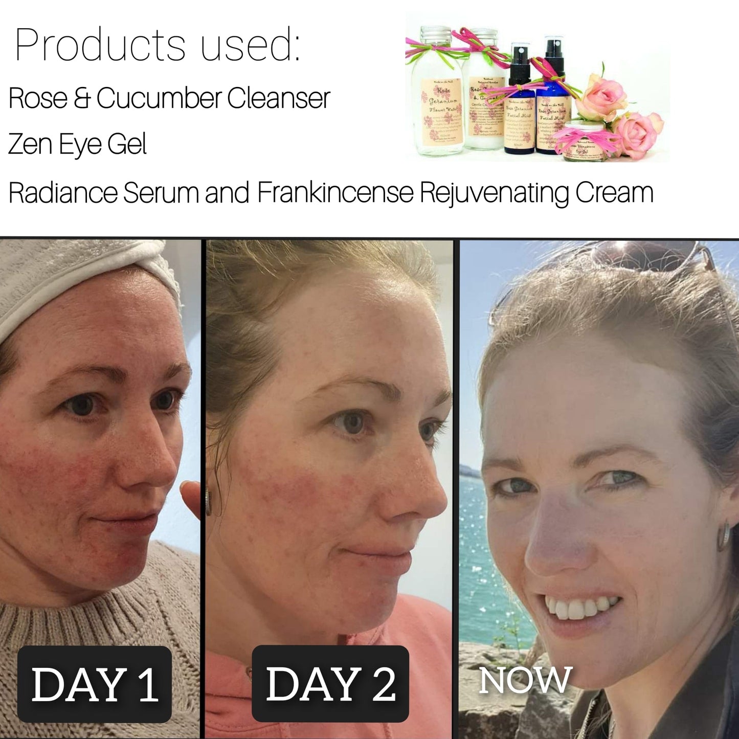 Set of 6 Dream Creams in Gorgeous Limited Edition Bag 🔥 Six Iconic Creams, One Unforgettable Collection 🔥